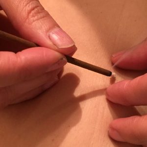 A photo showing a practitioner applying rice grain moxa to their patient's skin.