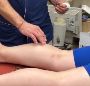 Felip Caudet treating a patient using Fukaya style moxibustion