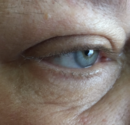 an eye with wrinkles around it